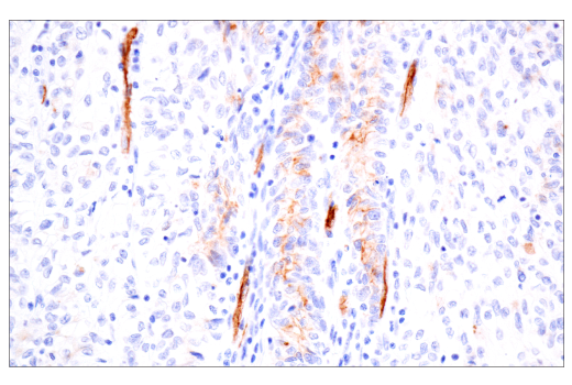 Immunohistochemistry Image 5: PODXL (E8O1S) Rabbit Monoclonal Antibody