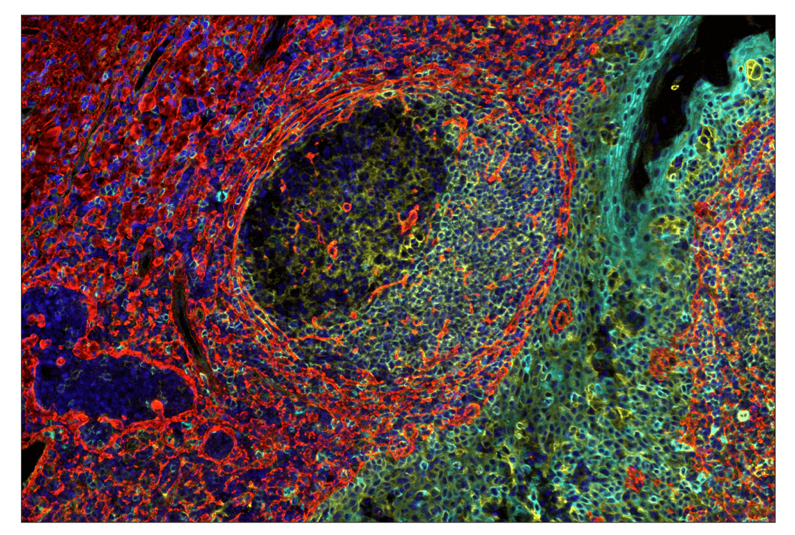 Immunohistochemistry Image 1: Phospho-S6 Ribosomal Protein (Ser235/236) (D57.2.2E) & CO-0107-750 SignalStar<sup>™</sup> Oligo-Antibody Pair