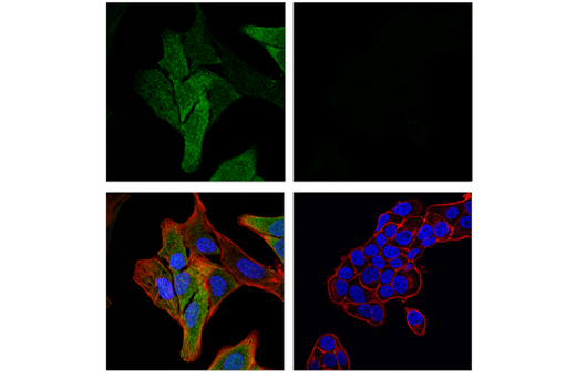 Immunofluorescence Image 1: MAGE-A4 (E7O1U) Rabbit Monoclonal Antibody (BSA and Azide Free)
