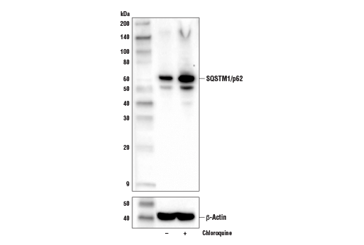 Western Blotting Image 2: SQSTM1/p62 (D6M5X) Rabbit Monoclonal Antibody