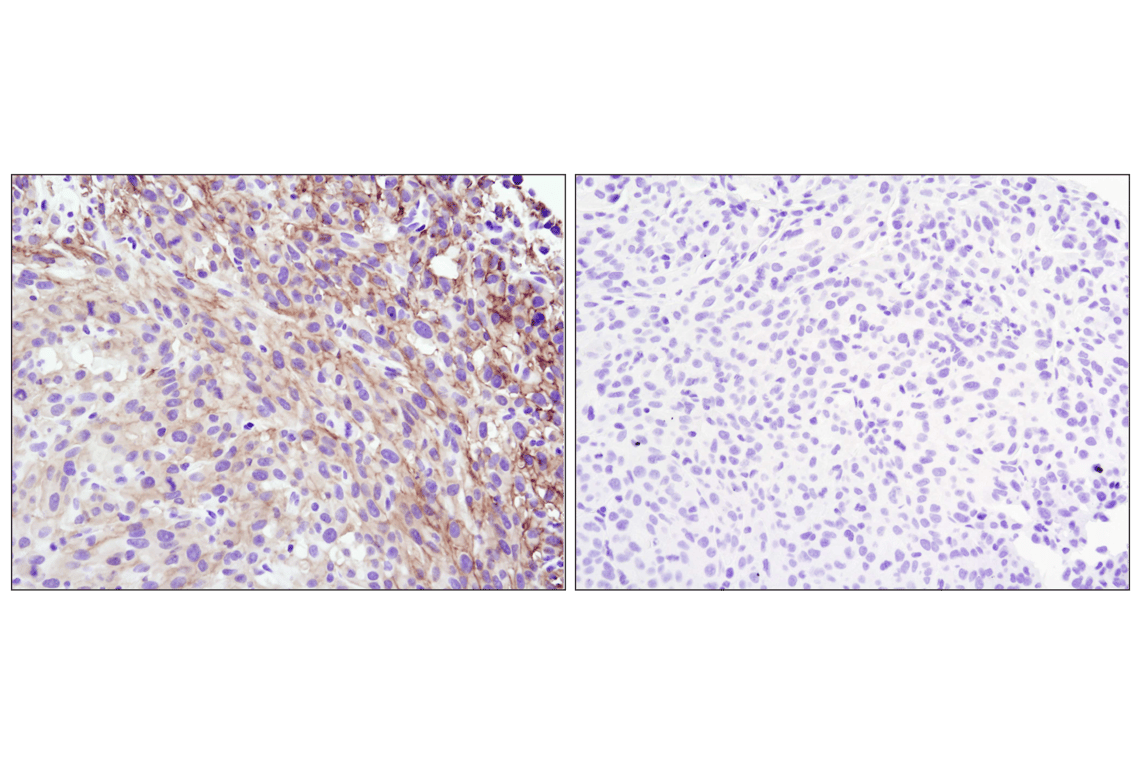 Immunohistochemistry Image 6: Phospho-Akt (Ser473) (D9E) Rabbit Monoclonal Antibody (BSA and Azide Free)