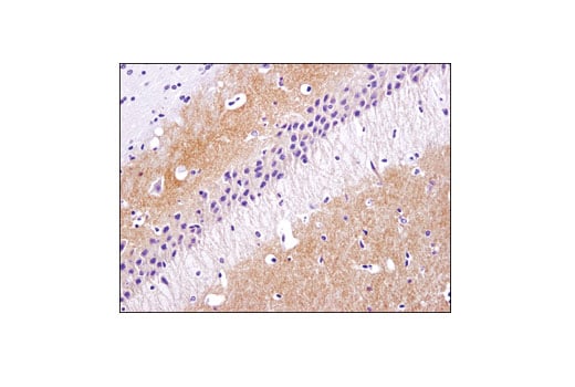 Immunohistochemistry Image 3: TrkC (C44H5) Rabbit Monoclonal Antibody