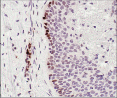 Immunohistochemical analysis of paraffin-embedded human tonsil using CD19 (Intracellular Domain) (D4V4B) XP<sup>®</sup> Rabbit mAb.