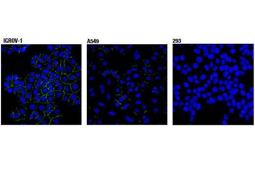 undefined Image 13: Epithelial-Mesenchymal Transition (EMT) IF Antibody Sampler Kit