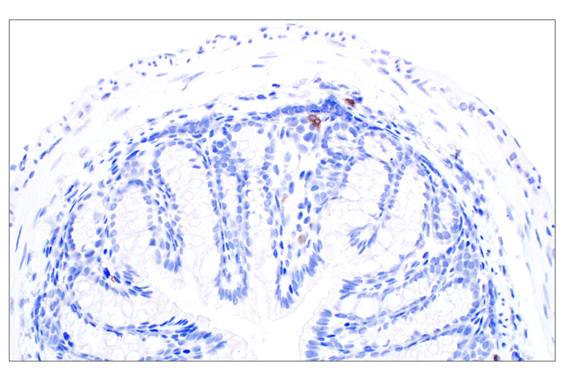 Immunohistochemistry Image 6: NCR1/NKp46 (F8M2L) Rabbit Monoclonal Antibody (IHC Formulated)