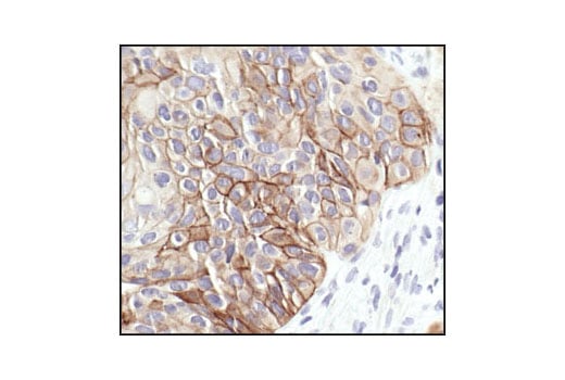 Immunohistochemistry Image 4: Phospho-HER2/ErbB2 (Tyr1221/1222) (6B12) Rabbit Monoclonal Antibody (BSA and Azide Free)