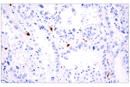 Immunohistochemistry Image 5: Calretinin (E7R6O) Rabbit Monoclonal Antibody (BSA and Azide Free)