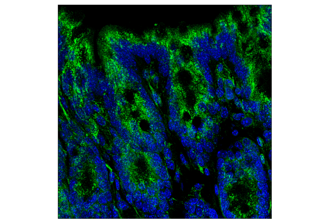 Immunofluorescence Image 3: LAMP2A (F1A5A) Rabbit Monoclonal Antibody