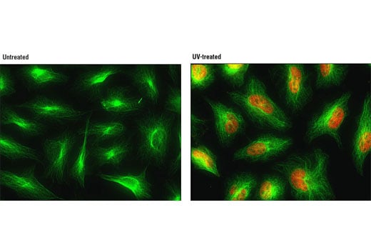Immunofluorescence Image 1: Phospho-p38 MAPK (Thr180/Tyr182) (D3F9) Rabbit Monoclonal Antibody (Alexa Fluor<sup>®</sup> 555 Conjugate)