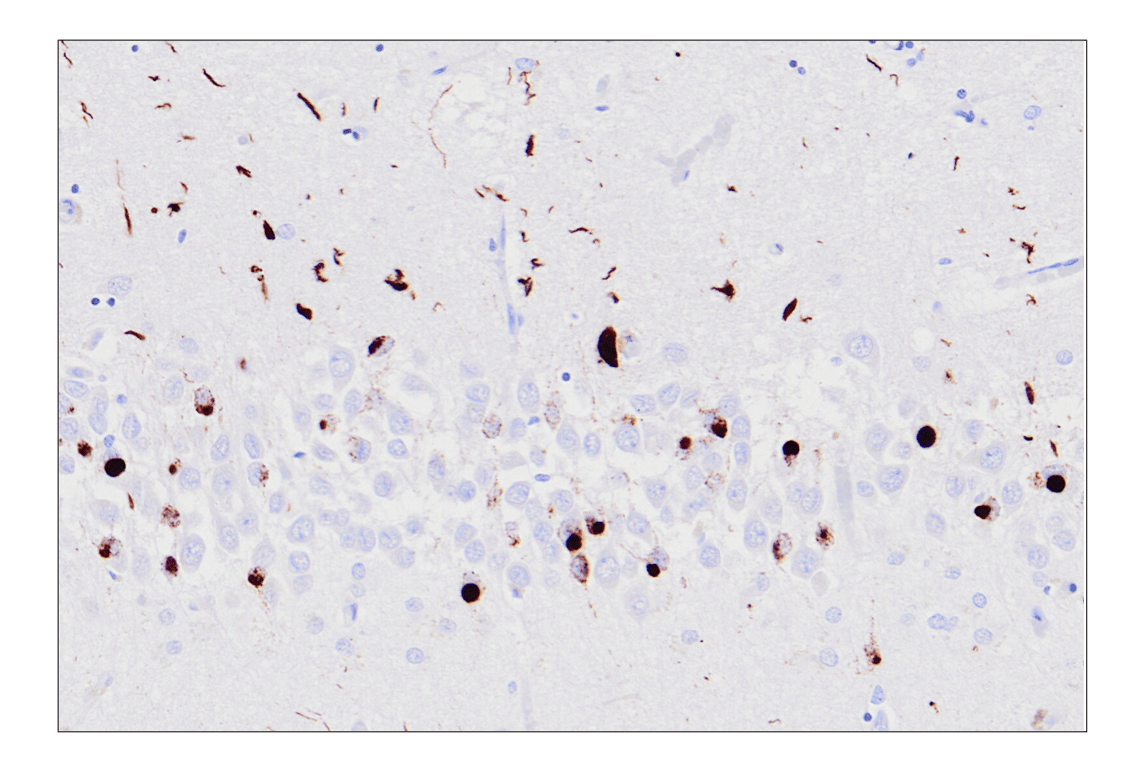 Immunohistochemistry Image 1: Phospho-TDP43 (Ser409/Ser410) (F9S3F) Rabbit Monoclonal Antibody