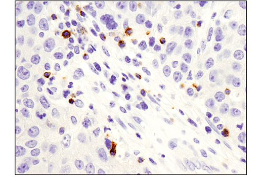 Immunohistochemistry Image 1: LAG3 (D2G4O) Rabbit Monoclonal Antibody (BSA and Azide Free)
