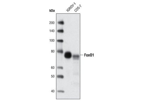 undefined Image 12: Forkhead Signaling Antibody Sampler Kit