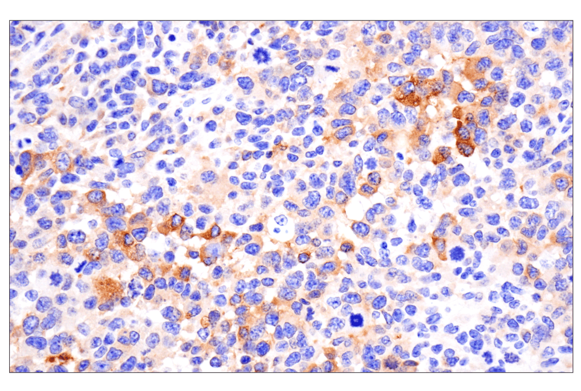 Immunohistochemistry Image 10: Phospho-Tau (Ser396) (F3S9T) Rabbit Monoclonal Antibody