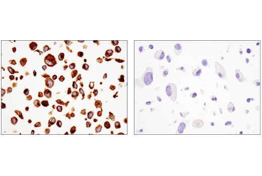 Immunohistochemistry Image 5: GPNMB (E4D7P) Rabbit Monoclonal Antibody