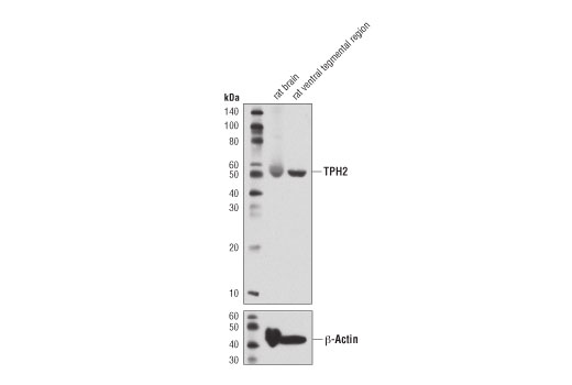 Western Blotting Image 2: TPH2 (D3E5I) Rabbit Monoclonal Antibody
