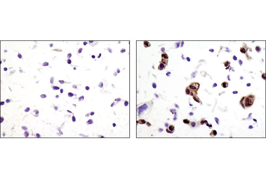 Immunohistochemistry Image 3: Phospho-p90RSK (Thr359) (D1E9) Rabbit Monoclonal Antibody (BSA and Azide Free)