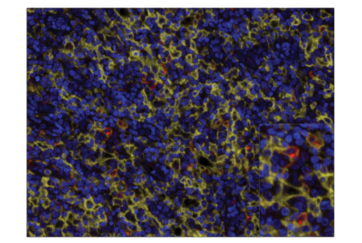 XCR1 (D2F8T) Rabbit mAb (BSA and Azide Free) (#63684