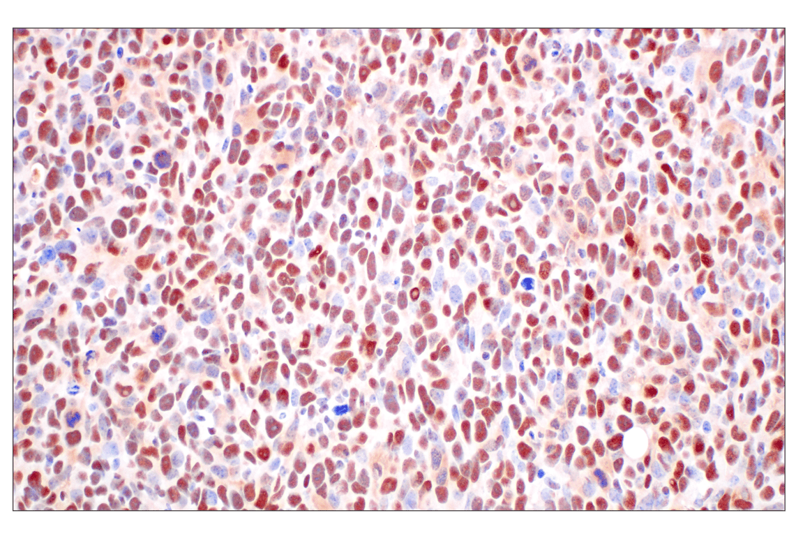 Immunohistochemistry Image 7: FKBP5 (F1G3I) Rabbit Monoclonal Antibody
