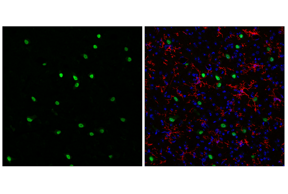 Immunofluorescence Image 3: SIX3 (F1I1S) Rabbit Monoclonal Antibody