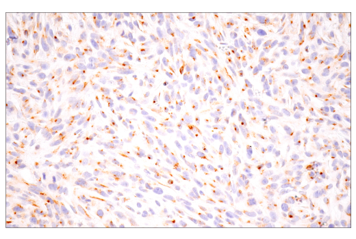Immunohistochemistry Image 8: Furin (E2Y2F) Rabbit Monoclonal Antibody