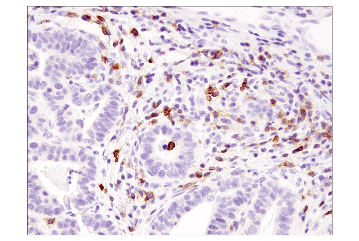Immunohistochemistry Image 3: ICOS (D1K2T<sup>™</sup>) Rabbit Monoclonal Antibody (BSA and Azide Free)