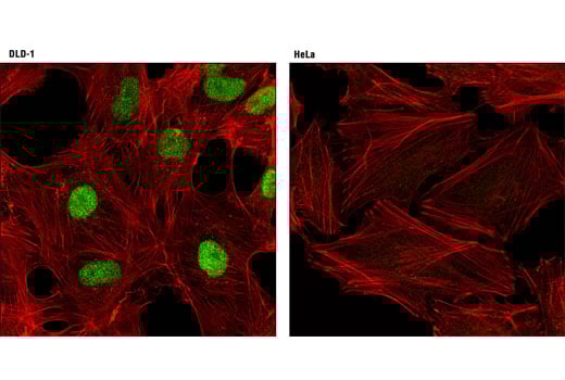 Immunofluorescence Image 1: CDX2 (D11D10) Rabbit Monoclonal Antibody