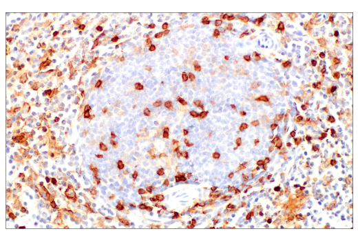 Immunohistochemistry Image 8: CD4 (EP204) Rabbit Monoclonal Antibody