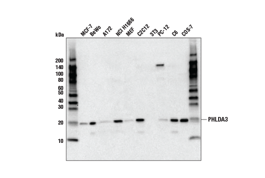 undefined Image 2: PHLDA3 Antibody