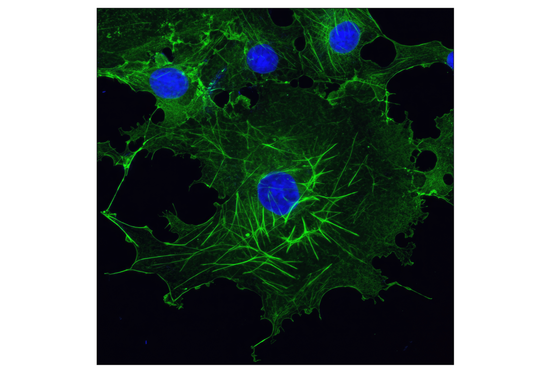 Immunofluorescence Image 1: beta-Actin (13E5) Rabbit Monoclonal Antibody