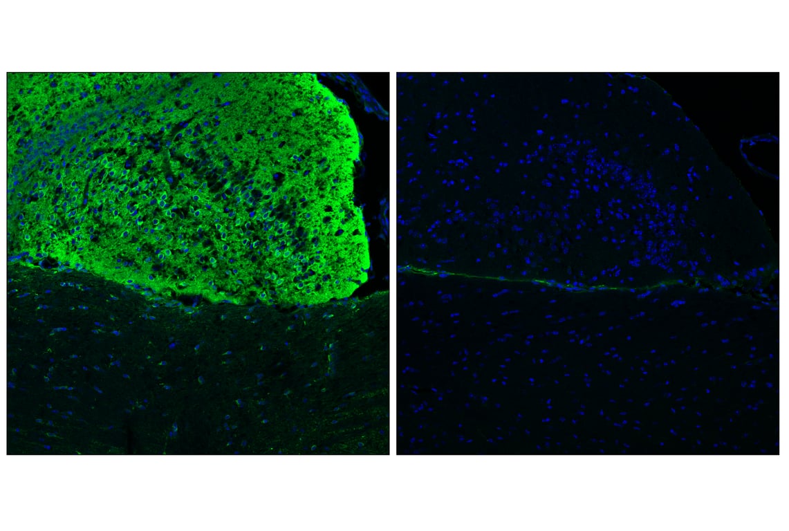 Immunofluorescence Image 2: Phospho-Tau (Thr205) (E8Q5Z) Mouse Monoclonal Antibody (BSA and Azide Free)