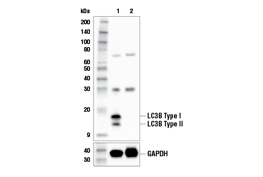 undefined Image 27: Xenophagy Antibody Sampler Kit