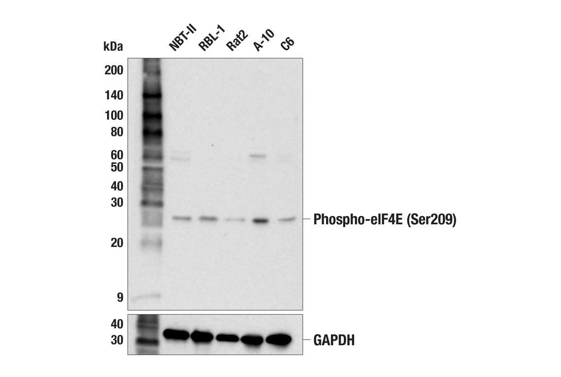 Western Blotting Image 3: Phospho-eIF4E (Ser209) (F4E5N) Rabbit Monoclonal Antibody