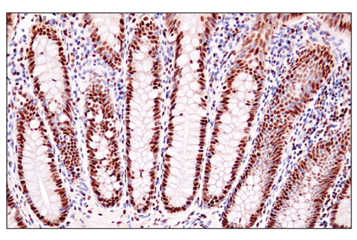 Immunohistochemistry Image 1: ADAR1 (E6X9R) Rabbit Monoclonal Antibody (BSA and Azide Free)