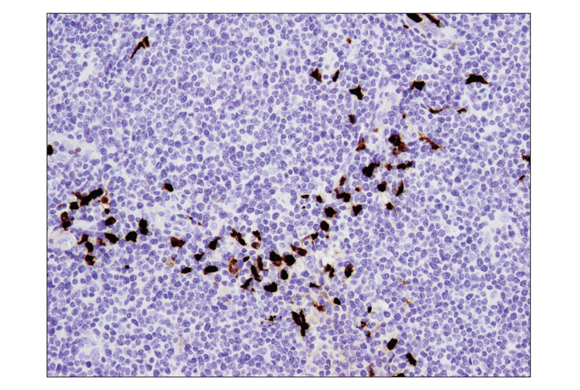 Immunohistochemistry Image 3: S100A9 (D5O6O) Rabbit Monoclonal Antibody (BSA and Azide Free)
