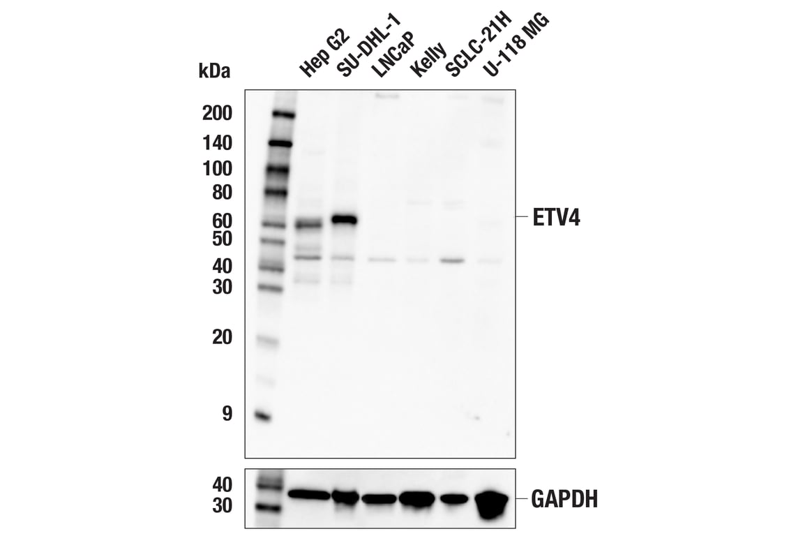 Western Blotting Image 3: ETV4 (E1W1G) Rabbit Monoclonal Antibody