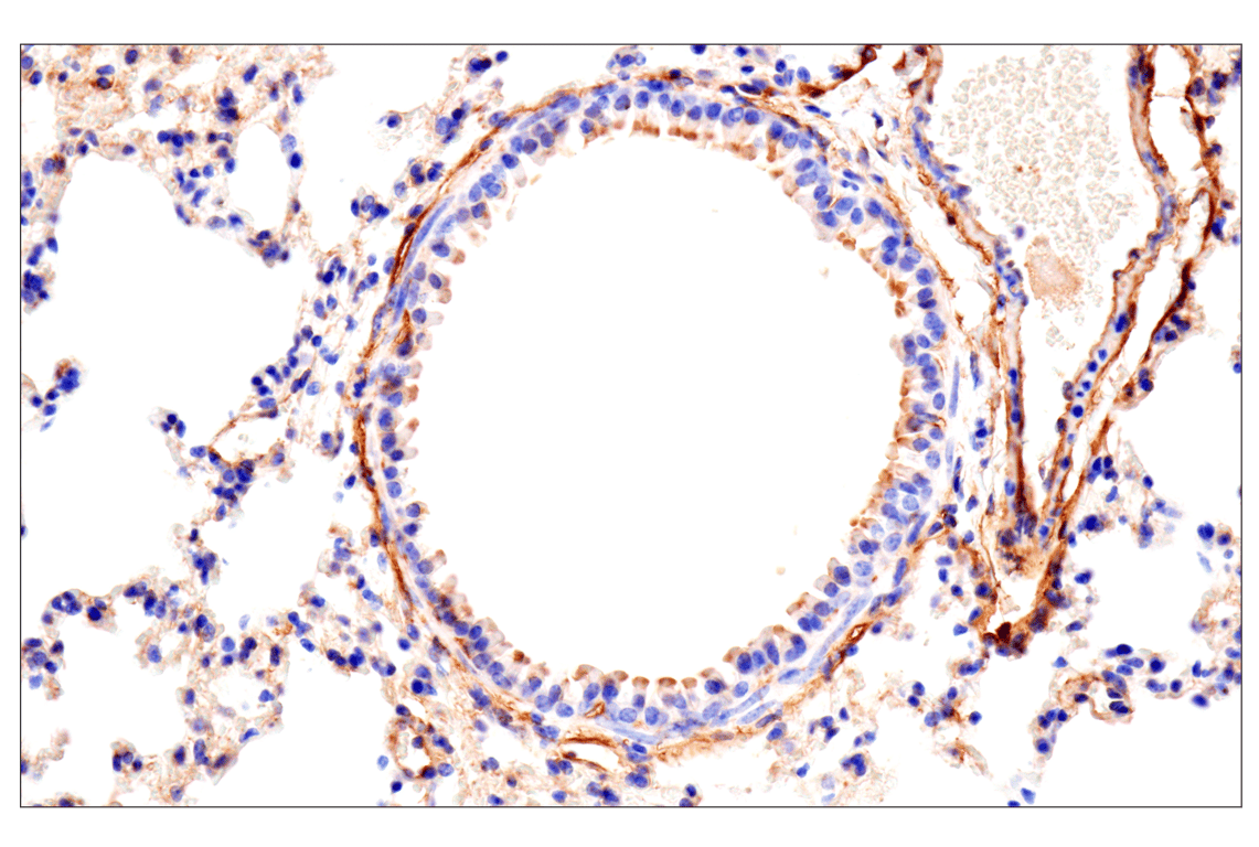 undefined Image 17: Mouse Reactive Exosome Marker Antibody Sampler Kit