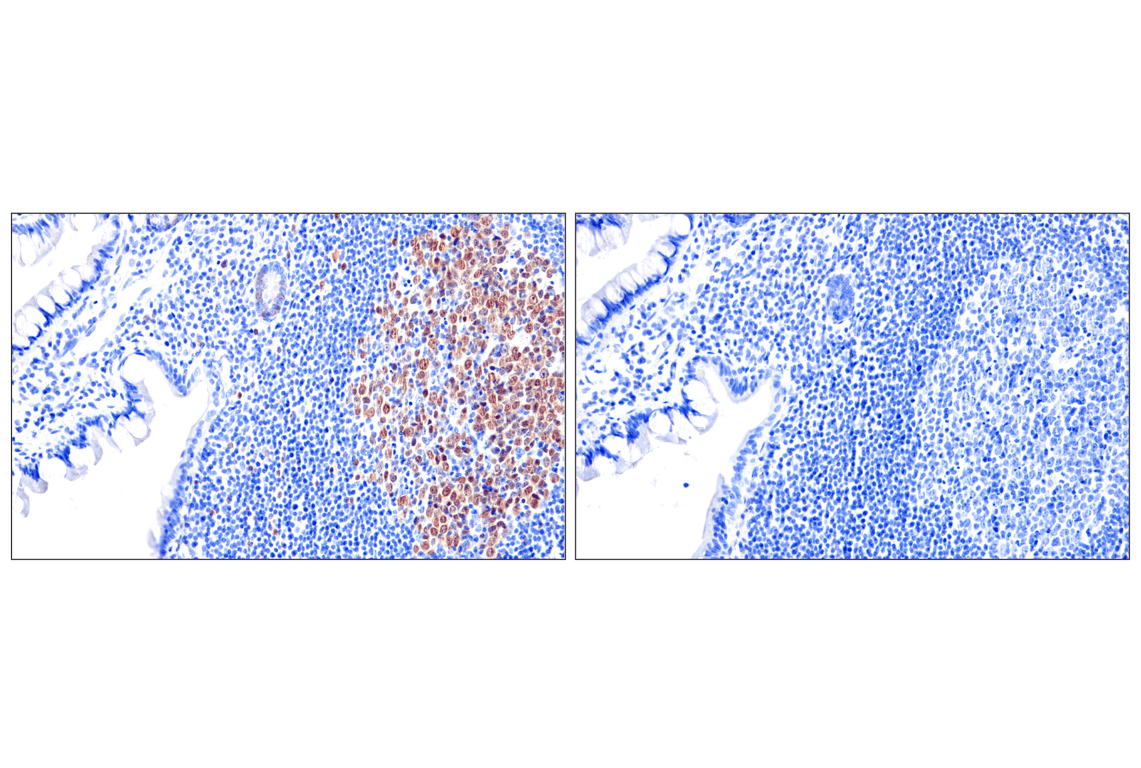 Immunohistochemistry Image 13: Chk1 (2G1D5) Mouse mAb