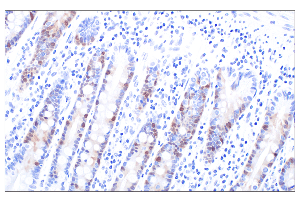 Immunohistochemistry Image 8: PBK/TOPK (F2X2Z) Rabbit Monoclonal Antibody