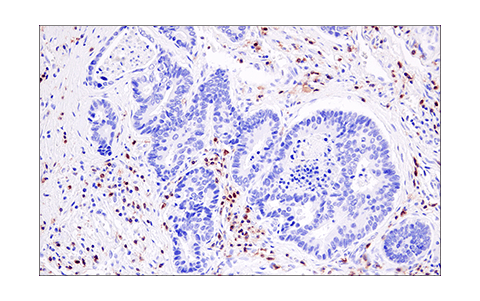 Immunohistochemistry Image 2: LAT (E3U6J) Rabbit Monoclonal Antibody (BSA and Azide Free)