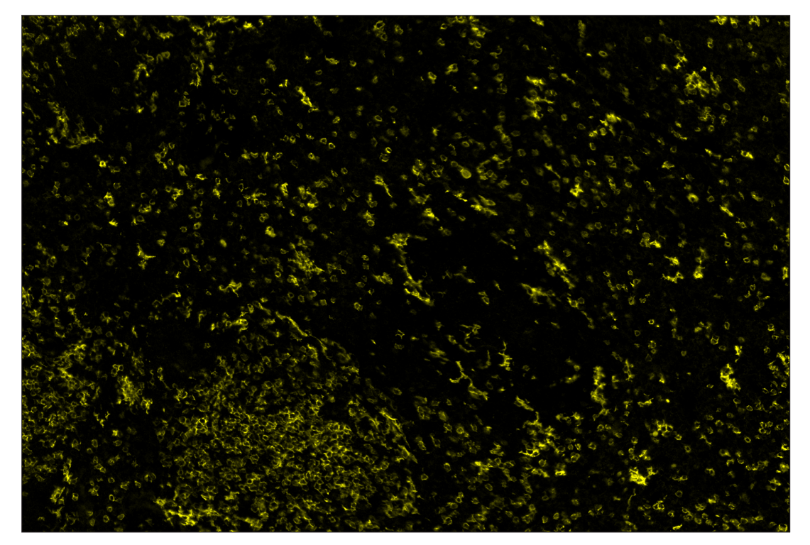 Immunohistochemistry Image 3: CD8α (D4W2Z) & CO-0040-647 SignalStar<sup>™</sup> Oligo-Antibody Pair