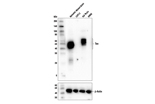 undefined Image 4: PhosphoPlus<sup>®</sup> Tau (Thr181) Antibody Duet