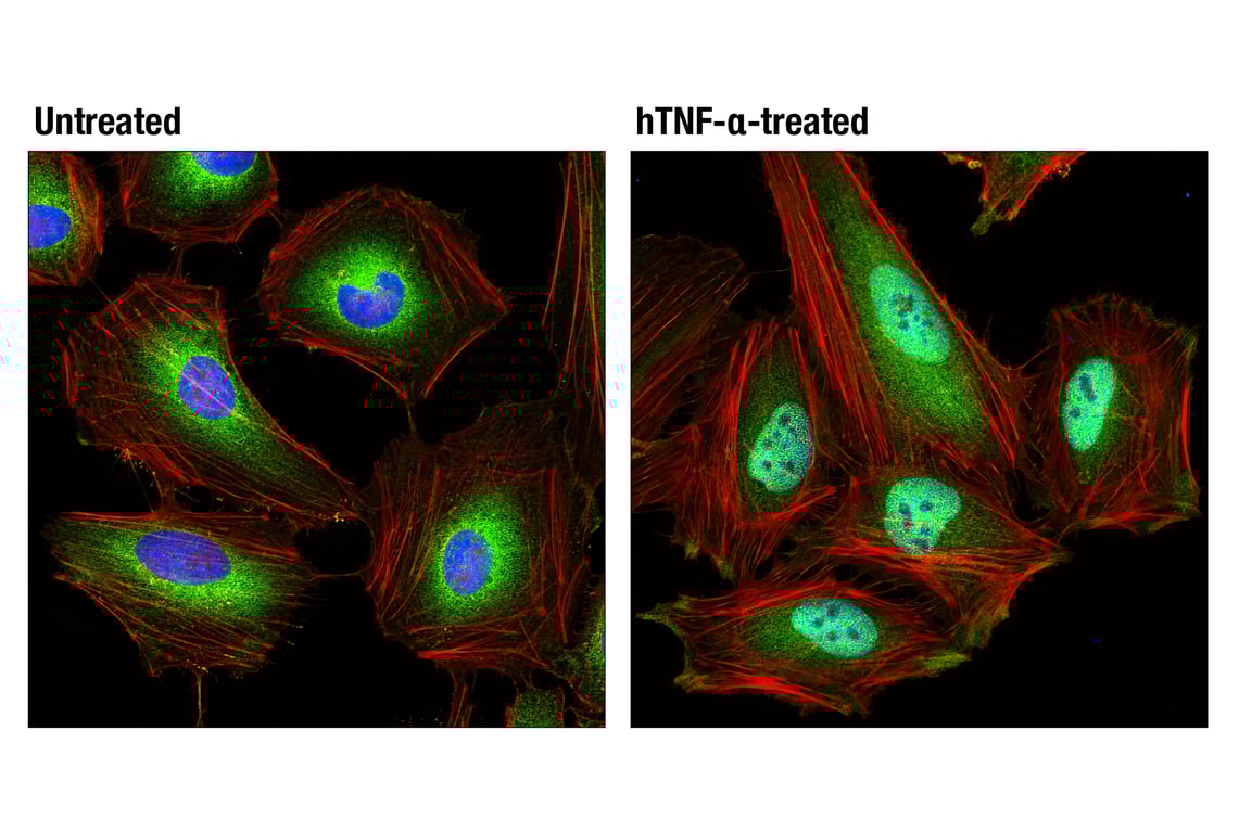 undefined Image 17: NF-kappaB p65 Antibody Sampler Kit
