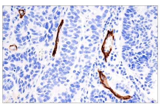 Immunohistochemistry Image 1: CD62P/P-Selectin (E8Q1W) Rabbit Monoclonal Antibody