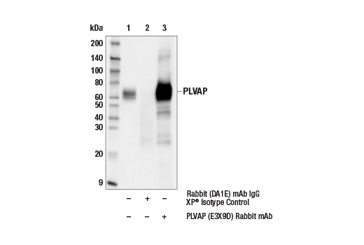 Immunoprecipitation Image 1: PLVAP (E3X9D) Rabbit Monoclonal Antibody