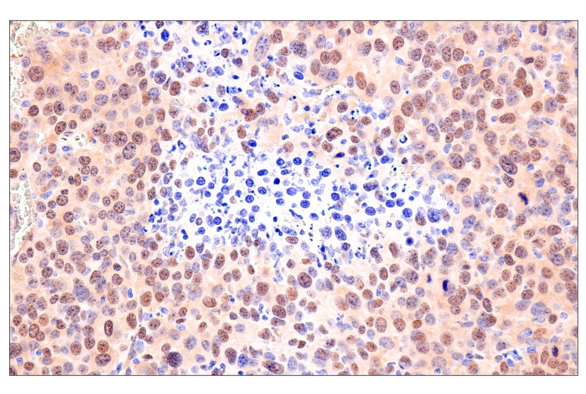 Immunohistochemistry Image 9: Phospho-YAP (Ser61) (E4Q8S) Rabbit Monoclonal Antibody