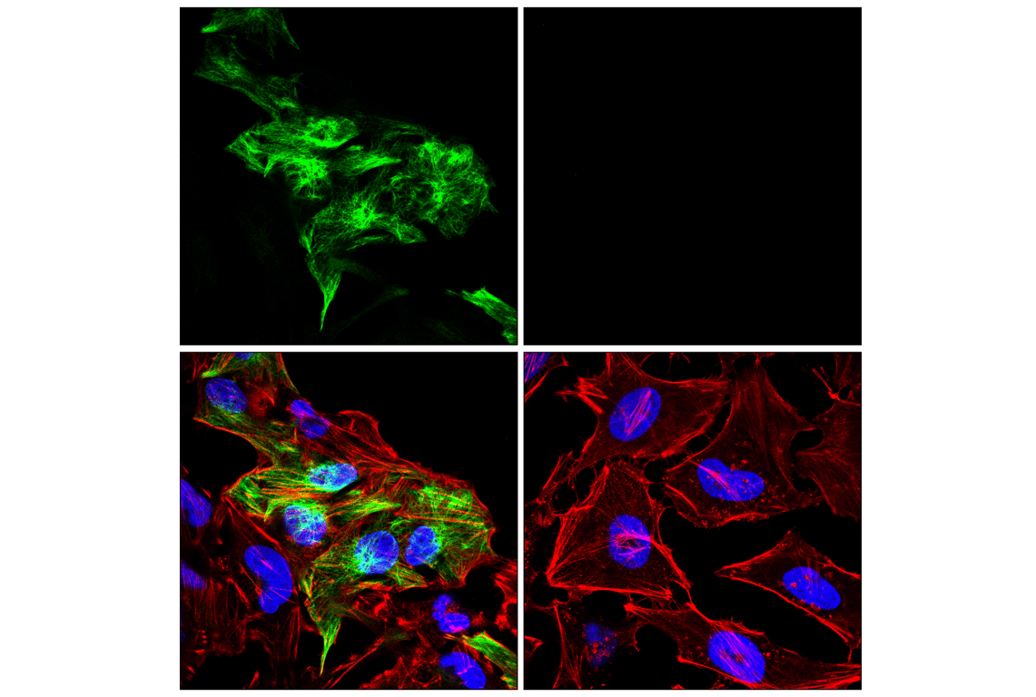 Immunofluorescence Image 1: GFAP (E4L7M) XP<sup>®</sup> Rabbit mAb (BSA and Azide Free)