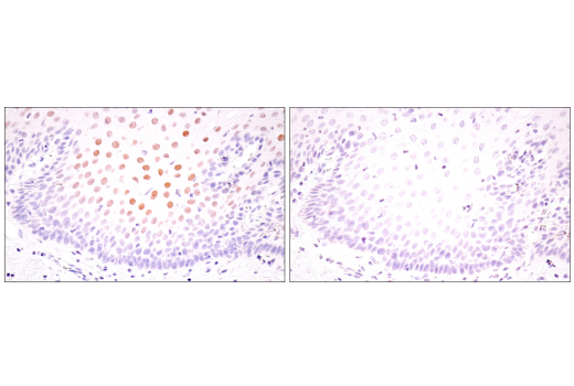 Immunohistochemistry Image 8: HIF-1 alpha (E1V6A) Rabbit Monoclonal Antibody (BSA and Azide Free)