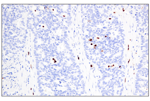 Immunohistochemistry Image 1: Arginase-1 (E4U1I) Mouse Monoclonal Antibody (BSA and Azide Free)