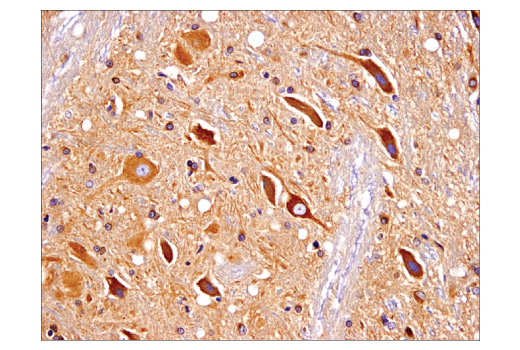 Immunohistochemistry Image 3: Huntingtin (D7F7) XP<sup>®</sup> Rabbit mAb (BSA and Azide Free)
