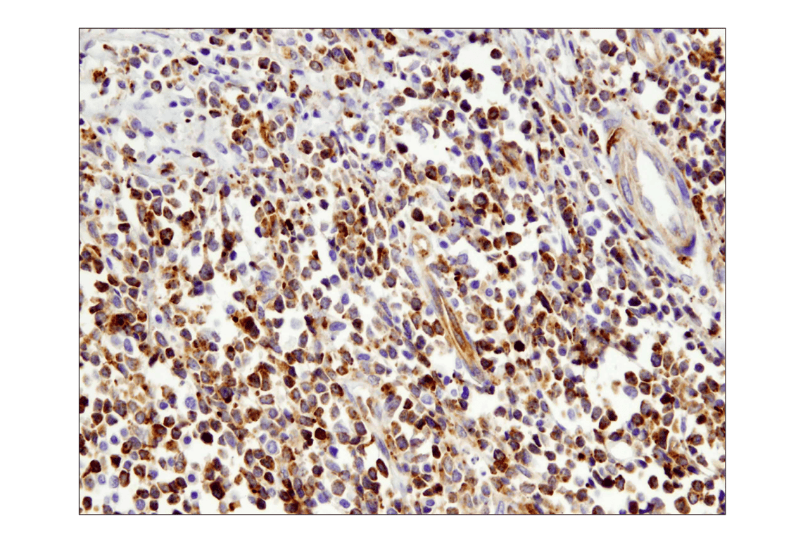 Immunohistochemistry Image 2: VISTA (D1L2G) Rabbit Monoclonal Antibody